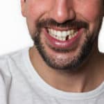 man missing tooth