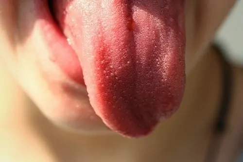 tongue